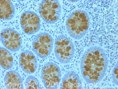 Immunohistochemistry (Formalin/PFA-fixed paraffin-embedded sections) - Anti-MUC2 antibody (AB90007)