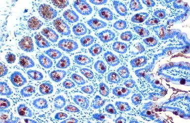 Immunohistochemistry (Formalin/PFA-fixed paraffin-embedded sections) - Anti-MUC2 antibody (AB97386)