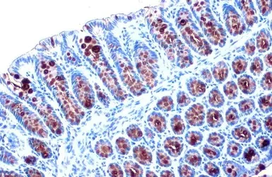Immunohistochemistry (Formalin/PFA-fixed paraffin-embedded sections) - Anti-MUC2 antibody (AB97386)