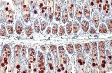 Immunohistochemistry (Formalin/PFA-fixed paraffin-embedded sections) - Anti-MUC2 antibody (AB97386)