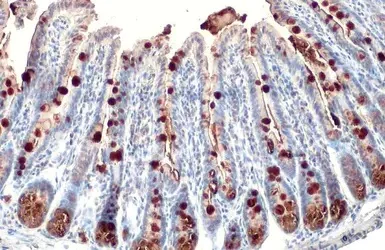 Immunohistochemistry (Formalin/PFA-fixed paraffin-embedded sections) - Anti-MUC2 antibody (AB97386)