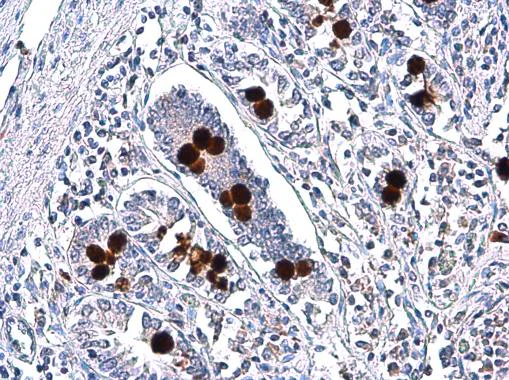 Immunohistochemistry (Formalin/PFA-fixed paraffin-embedded sections) - Anti-MUC2 antibody (AB97386)