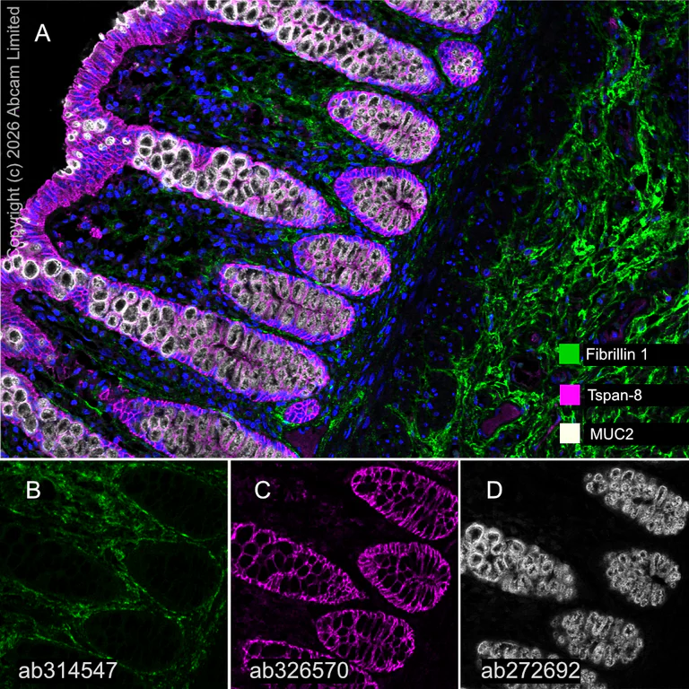 Multiplex immunohistochemistry - Anti-MUC2 antibody [EPR23479-47] (AB272692)