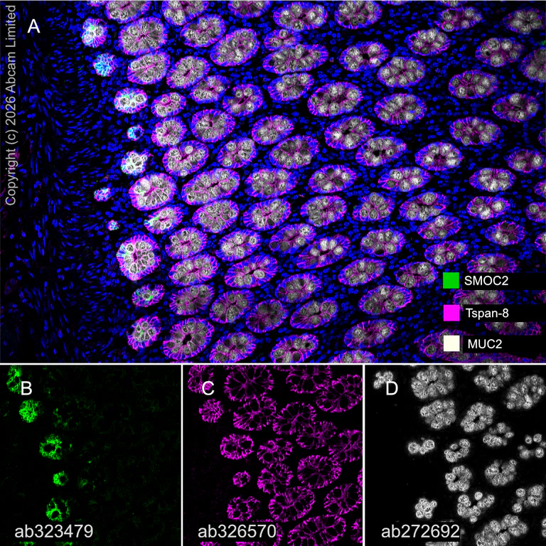 Multiplex immunohistochemistry - Anti-MUC2 antibody [EPR23479-47] (AB272692)
