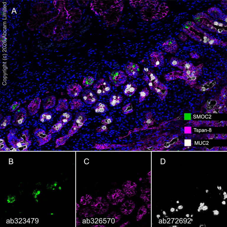 Multiplex immunohistochemistry - Anti-MUC2 antibody [EPR23479-47] (AB272692)
