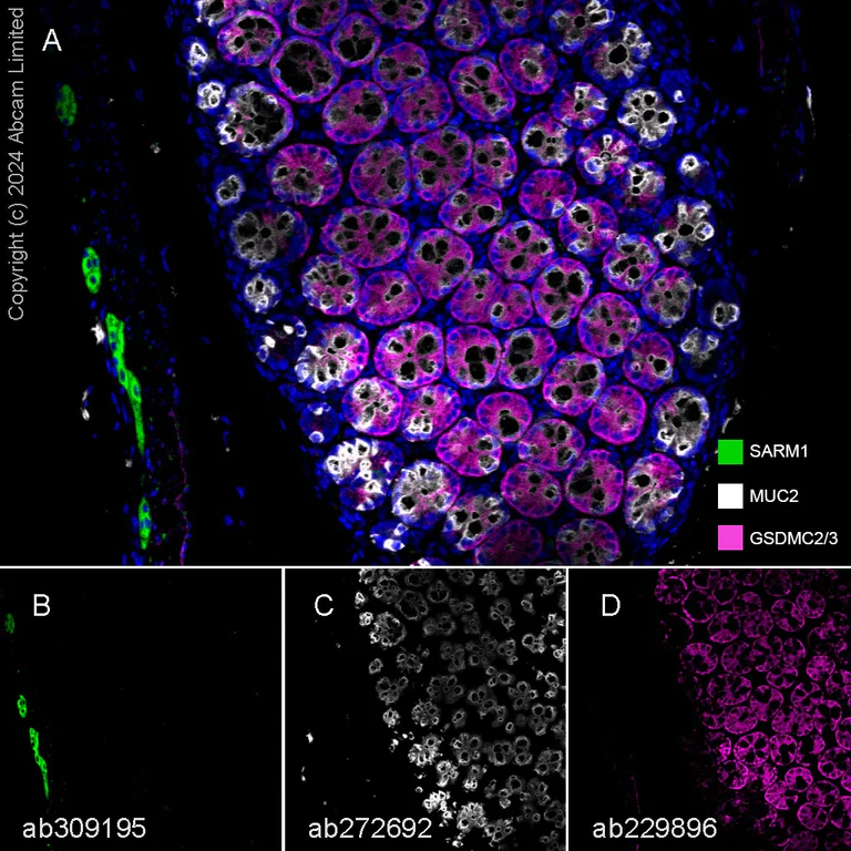 Multiplex immunohistochemistry - Anti-MUC2 antibody [EPR23479-47] - BSA and Azide free (AB272706)
