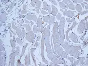 Immunohistochemistry (Formalin/PFA-fixed paraffin-embedded sections) - Anti-MUC2 antibody [EPR6145] (AB134119)