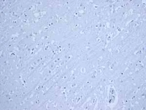 Immunohistochemistry (Formalin/PFA-fixed paraffin-embedded sections) - Anti-MUC2 antibody [EPR6145] (AB134119)