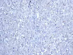 Immunohistochemistry (Formalin/PFA-fixed paraffin-embedded sections) - Anti-MUC2 antibody [EPR6145] - Low endotoxin, Azide free (AB177278)