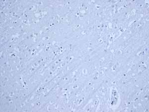 Immunohistochemistry (Formalin/PFA-fixed paraffin-embedded sections) - Anti-MUC2 antibody [EPR6145] - Low endotoxin, Azide free (AB177278)