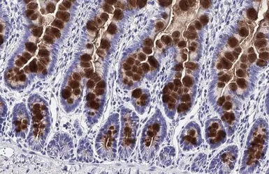 Immunohistochemistry paraffin embedded sections - Anti-MUC2 antibody [HL1724] (AB308191), expandable thumbnail