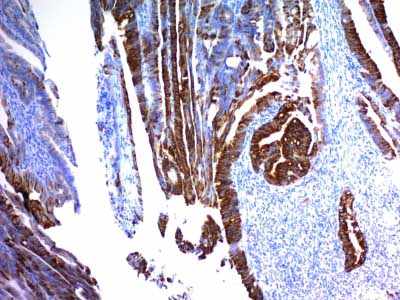 Immunohistochemistry (Formalin/PFA-fixed paraffin-embedded sections) - Anti-MUC2 antibody [MLP/842] - BSA and Azide free (AB212635)