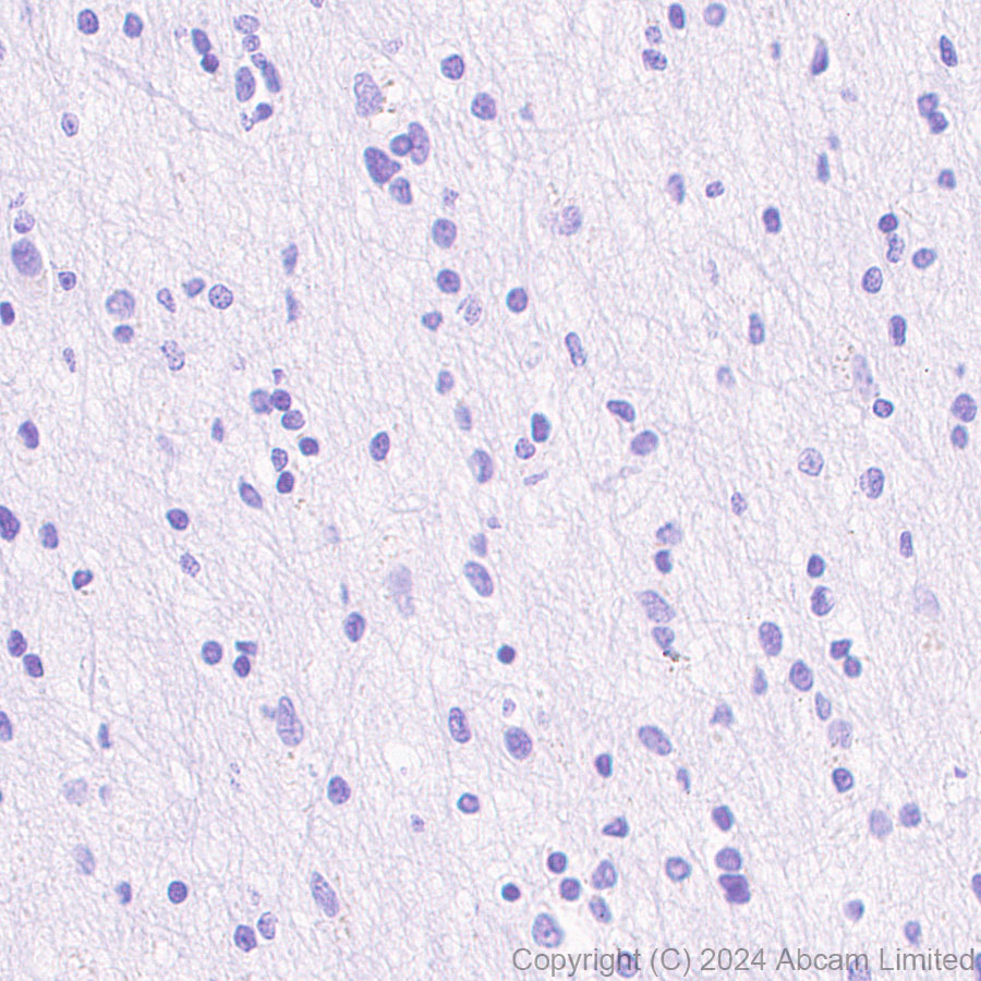 Immunohistochemistry (Formalin/PFA-fixed paraffin-embedded sections) - Anti-MUC2 antibody [RM1281] (ab322964), expandable thumbnail