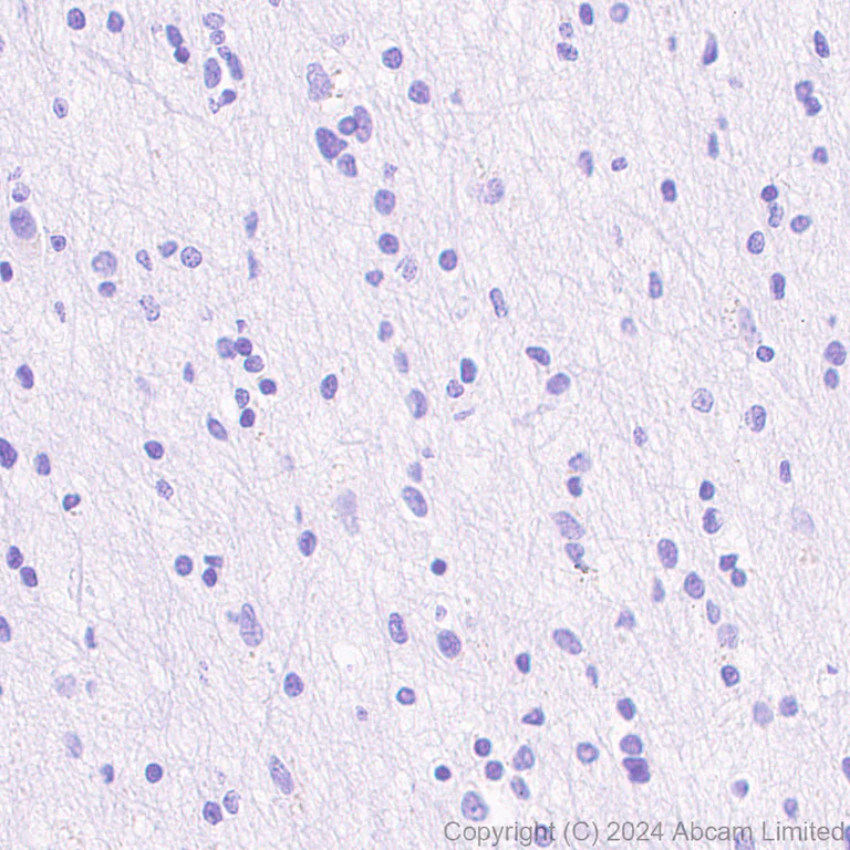Immunohistochemistry (Formalin/PFA-fixed paraffin-embedded sections) - Anti-MUC2 antibody [RM1281] (AB322964)