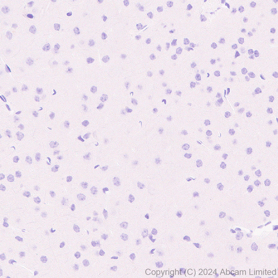 Immunohistochemistry (Formalin/PFA-fixed paraffin-embedded sections) - Anti-MUC2 antibody [RM1281] (ab322964), expandable thumbnail
