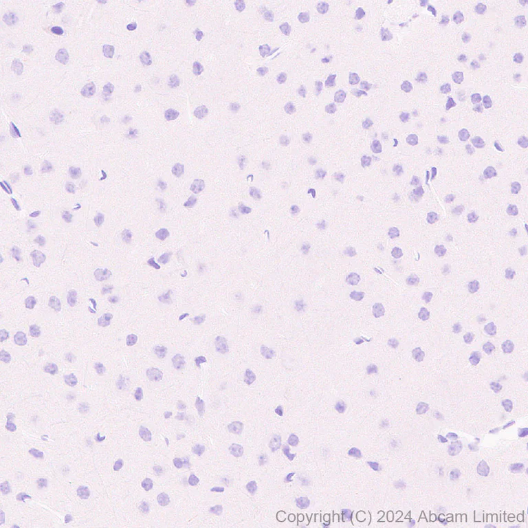 Immunohistochemistry (Formalin/PFA-fixed paraffin-embedded sections) - Anti-MUC2 antibody [RM1281] (AB322964)
