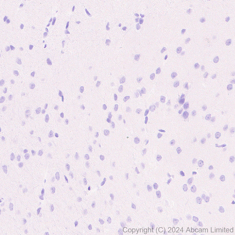 Immunohistochemistry (Formalin/PFA-fixed paraffin-embedded sections) - Anti-MUC2 antibody [RM1281] (ab322964), expandable thumbnail