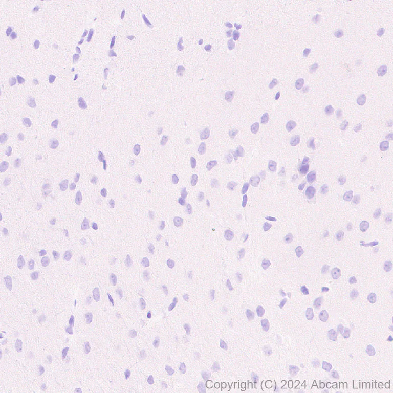 Immunohistochemistry (Formalin/PFA-fixed paraffin-embedded sections) - Anti-MUC2 antibody [RM1281] (AB322964)