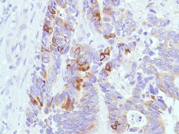 Immunohistochemistry (Formalin/PFA-fixed paraffin-embedded sections) - Anti-MUC2 antibody [SPM512] (AB231427)