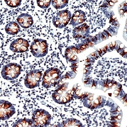 Immunohistochemistry (Formalin/PFA-fixed paraffin-embedded sections) - Anti-MUC2 antibody [SPM512] (AB231427)