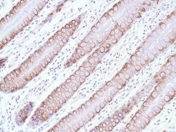 Immunohistochemistry (Formalin/PFA-fixed paraffin-embedded sections) - Anti-MUC2 antibody [SPM512] (AB231427)