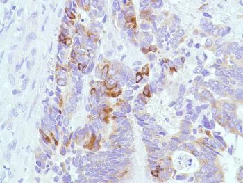 Immunohistochemistry (Formalin/PFA-fixed paraffin-embedded sections) - Anti-MUC2 antibody [SPM513], prediluted (AB52130)