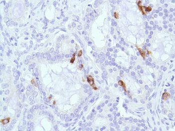 Immunohistochemistry (Formalin/PFA-fixed paraffin-embedded sections) - Anti-MUC2 antibody [SPM513], prediluted (AB52130), expandable thumbnail