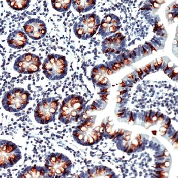 Immunohistochemistry (Formalin/PFA-fixed paraffin-embedded sections) - Anti-MUC2 antibody [SPM513], prediluted (AB52130), expandable thumbnail
