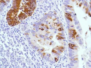 Immunohistochemistry (Formalin/PFA-fixed paraffin-embedded sections) - Anti-MUC2 antibody [SPM513], prediluted (AB52130)