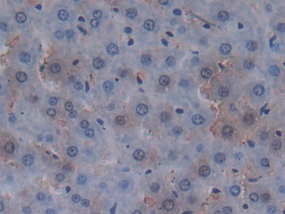 Immunohistochemistry (Formalin/PFA-fixed paraffin-embedded sections) - Anti-MUC20 antibody (AB231659), expandable thumbnail
