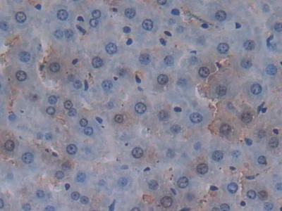 Immunohistochemistry (Formalin/PFA-fixed paraffin-embedded sections) - Anti-MUC20 antibody (AB231659)