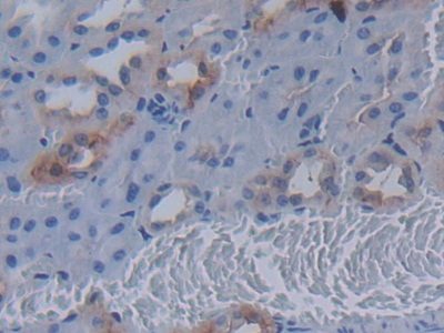 Immunohistochemistry (Formalin/PFA-fixed paraffin-embedded sections) - Anti-MUC20 antibody (AB231659), expandable thumbnail