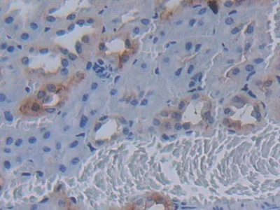 Immunohistochemistry (Formalin/PFA-fixed paraffin-embedded sections) - Anti-MUC20 antibody (AB231659)