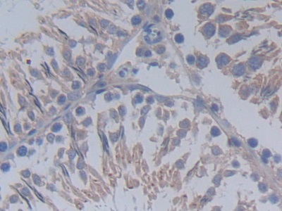 Immunohistochemistry (Formalin/PFA-fixed paraffin-embedded sections) - Anti-MUC20 antibody (AB231659), expandable thumbnail