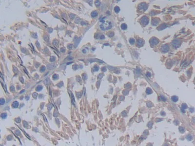 Immunohistochemistry (Formalin/PFA-fixed paraffin-embedded sections) - Anti-MUC20 antibody (AB231659)