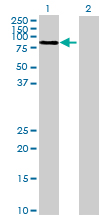Western blot - Anti-MUC20 antibody (AB73043), expandable thumbnail