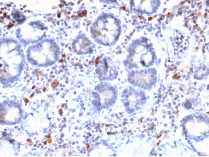 Immunohistochemistry (Formalin/PFA-fixed paraffin-embedded sections) - Anti-MUC3 antibody [MUC3/2992R] (AB270273), expandable thumbnail