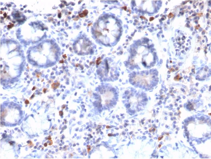 Immunohistochemistry (Formalin/PFA-fixed paraffin-embedded sections) - Anti-MUC3 antibody [MUC3/2992R] (AB270273)