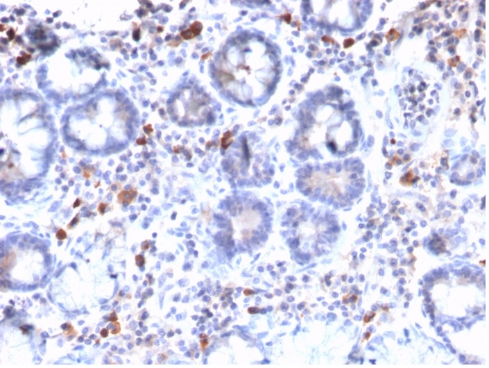 Immunohistochemistry (Formalin/PFA-fixed paraffin-embedded sections) - Anti-MUC3 antibody [MUC3/2992R] - BSA and Azide free (AB270304), expandable thumbnail