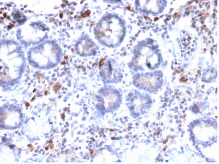 Immunohistochemistry (Formalin/PFA-fixed paraffin-embedded sections) - Anti-MUC3 antibody [MUC3/2992R] - BSA and Azide free (AB270304)