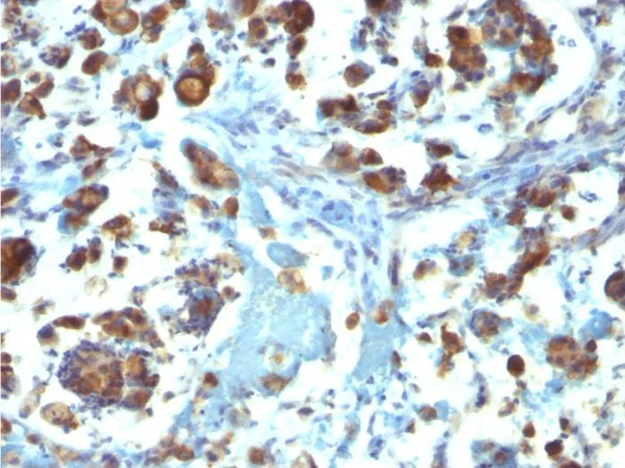 Immunohistochemistry (Formalin/PFA-fixed paraffin-embedded sections) - Anti-MUC3A antibody [M3.1] (AB270247)