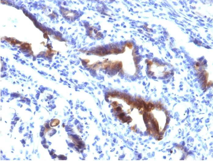 Immunohistochemistry (Formalin/PFA-fixed paraffin-embedded sections) - Anti-MUC3A antibody [M3.1] (AB270247)