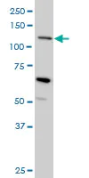 Western blot - Anti-MUC4 antibody [5B12] (AB60720)