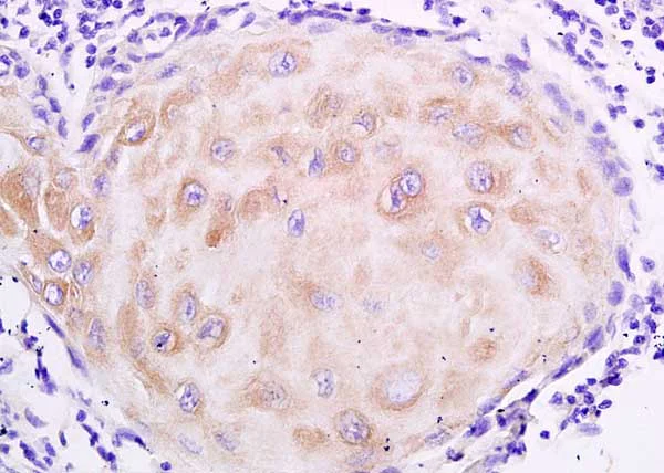 Immunohistochemistry (Formalin/PFA-fixed paraffin-embedded sections) - Anti-MUC4 antibody (AB214220)
