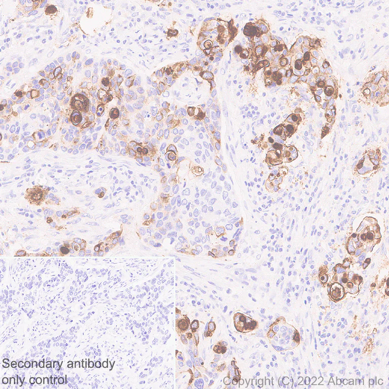 Immunohistochemistry (Formalin/PFA-fixed paraffin-embedded sections) - Anti-MUC4 antibody [EPR27199-56] (AB307546)