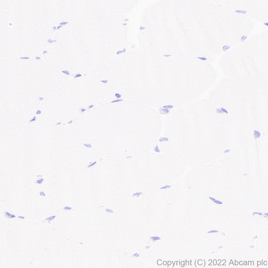 Immunohistochemistry (Formalin/PFA-fixed paraffin-embedded sections) - Anti-MUC4 antibody [EPR27199-56] (AB307546)