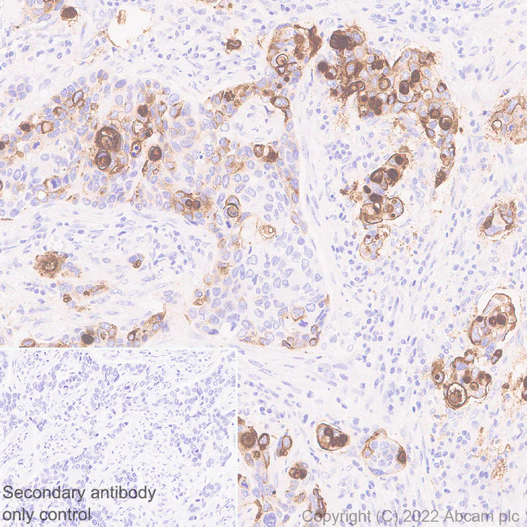 Immunohistochemistry (Formalin/PFA-fixed paraffin-embedded sections) - Anti-MUC4 antibody [EPR27199-56] - BSA and Azide free (AB307547)