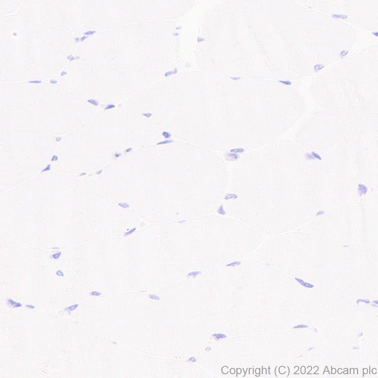 Immunohistochemistry (Formalin/PFA-fixed paraffin-embedded sections) - Anti-MUC4 antibody [EPR27199-56] - BSA and Azide free (AB307547)