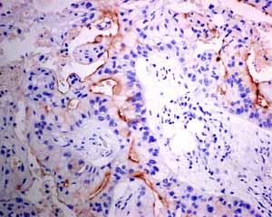 Immunohistochemistry (Formalin/PFA-fixed paraffin-embedded sections) - Anti-MUC4 antibody [EPR9308] (AB150381), expandable thumbnail