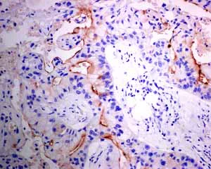 Immunohistochemistry (Formalin/PFA-fixed paraffin-embedded sections) - Anti-MUC4 antibody [EPR9308] (AB150381)